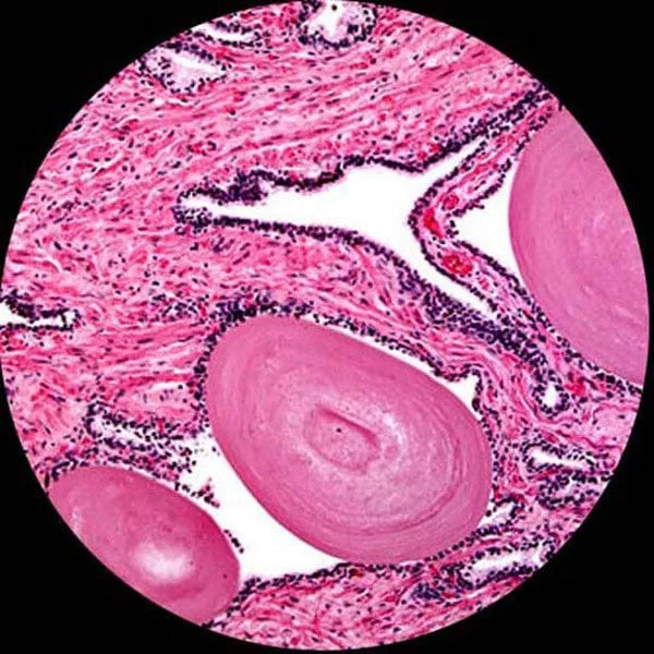 AmScope B390 Series Binocular Compound Microscope with 20W Halogen, 3D Mechanical Stage and Optional Digital Camera